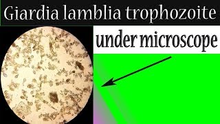 Giardia lamblia trophozoite under microscope In stool sample [upl. by Eillil]