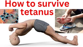 How to survive tetanus  tetanus treatment and cure tetanus sympyoms and prevention [upl. by Ariam]