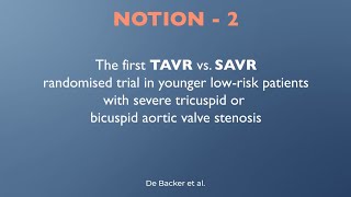 Shortterm data from NOTION2 TAVR vs SAVI for younger patients with aortic stenosis  EuroPCR 2024 [upl. by Assyl]