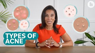 The Different Types of Acne and How to Treat Them [upl. by Gleda341]