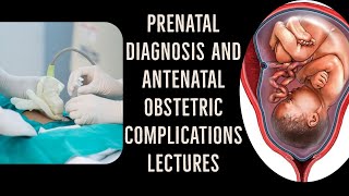 ANTENATAL OBSTETRIC COMPLICATIONS lecture 6 BREECH presentation management made simple [upl. by Nathanoj]