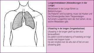 Wenn man nicht mehr gesund wird  Metastasen in Knochen Lunge Leber und Gehirn 26 [upl. by Hammond]