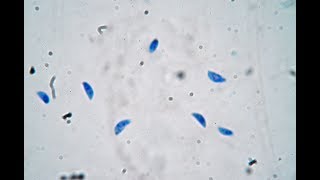 Toxoplasma gondii  live trophozoites [upl. by Lebasy704]