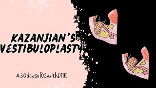 KAZANJIAN’S VESTIBULOPLASTY  PREPROSTHETIC SURGERY  30daysofOSwithDME [upl. by Doralyn]