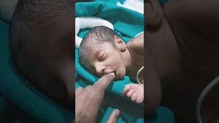 Preterm baby trending cutebaby ytshorts cute new viralvideo youtubeshorts youtube baby [upl. by Rempe125]