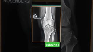 Rosenberg view xray support subscribe ytviralvideo youtubeshort xraytech [upl. by Lizzy]