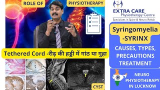 SYRINGOMYELIA  रीढ़ की हड्डी में गांठ या गुहा  SYRINX  Chiari malformation  Extra Care LUCKNOW [upl. by Atoel]