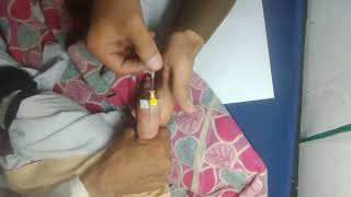 How To Intravenous Cannulation Baby 🍼 IV cannula fix cutebaby cannula ivcannulation hospital [upl. by Nnazil]