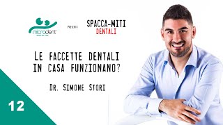 Le quotfaccettequot dentali come funzionano  Spaccamiti Dentali  1213 [upl. by Nnahteb435]