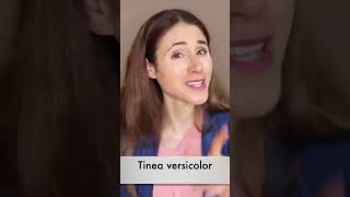 Tinea versicolor dermatologist DrDrayzday [upl. by Ahserb]