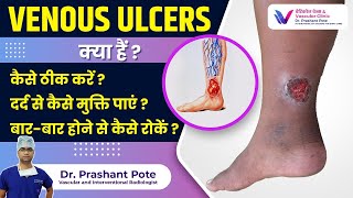 Venous Ulcers के लिए रामबाण इलाज Dr Prashant Pote द्वारा सलाह [upl. by Htyderem663]