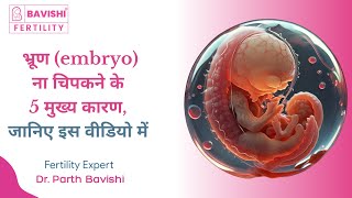 भ्रूण embryo ना चिपकने के 5 मुख्य कारण जानिए इस वीडियो में  Dr Parth Bavishi [upl. by Rengia]