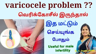 What is Varicocele in tamil  Varicocele Treatment  ஆண் மலட்டுத் தன்மைக்கு சிறந்த தீர்வு DrAswini [upl. by Keverian]