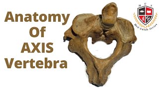 Axis Vertebra Anatomy 2nd Cervical VertebraHuman Osteology [upl. by Aiuqenehs]