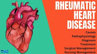 Rheumatic Heart Disease or RHD  Rheumatic Fever  Causes  Pathophysiology  The Nurses Station [upl. by Onifur545]