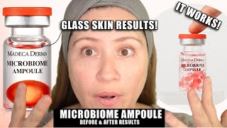 THIS MICROBIOME AMPOULE GIVES YOU GLASS SKIN  w Before amp Afters [upl. by Gustavo989]