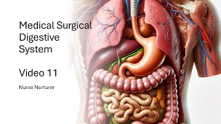 Video 11  🍏 Medical Surgical Gastrointestinal System  Nurse Nurturer [upl. by Gianina]