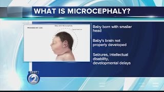 What is microcephaly [upl. by Annayram]