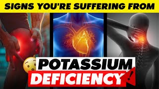 7 Alarming Signs Youre Suffering From Potassium Deficiency [upl. by Nappy]