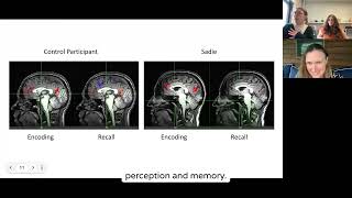 Watch what happens when an aphant tries to visualize fMRI [upl. by Nodnarbal]