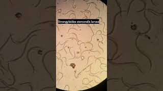 Strongyloides stercoralis larvae Strongyloidiasis parasiteParasite under microscope microscopy [upl. by Salohci]