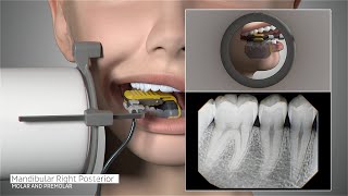 DEXIS™ Titanium by KaVo  Full Mouth Series Positioning Guide [upl. by Marleah]