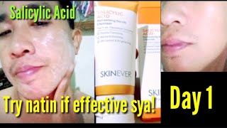 Day 1 Salicylic Acid effective ba [upl. by Danika]