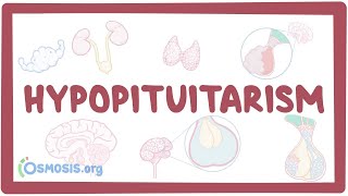 Hypopituitarism  causes symptoms diagnosis treatment pathology [upl. by Tucky]