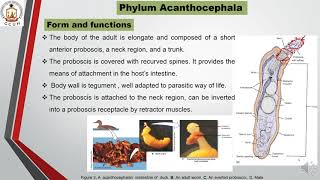 Phylum Acanthocephala [upl. by Nathanson588]