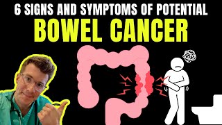 6 SIGNS AND SYMPTOMS OF BOWEL CANCER [upl. by Guibert]