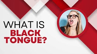 What is Black Tongue Top Common Causes You Should Know [upl. by Barkley]