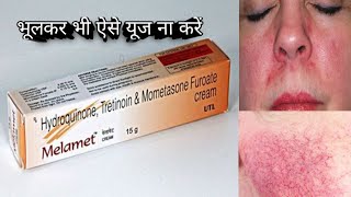 melamet cream use and sadi effect इस क्रीम की सच्चाई [upl. by Atelokin12]