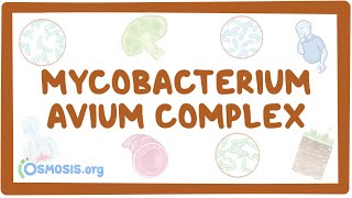 Mycobacterium avium complex  causes symptoms diagnosis treatment pathology [upl. by Davie892]