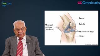 Osteoarthritis Hindi  IOACON 2017 [upl. by Herzog]