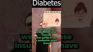 Thick Dead Skin on Feet amp Dry Skin on Feet Diabetes Skin Conditions [upl. by Anidualc]