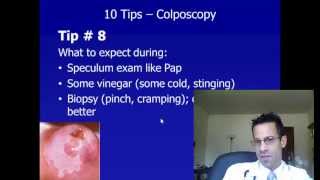 Colposcopy  To Tips to Know What to Expect and Know How To Prevent Cervical Cancer [upl. by Cassandre37]