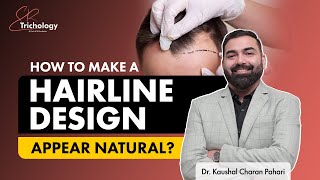 5 Factors for a natural looking Hairline Design  Hair Transplant Clinic in Gurgaon  SB Trichology [upl. by Kleiman527]