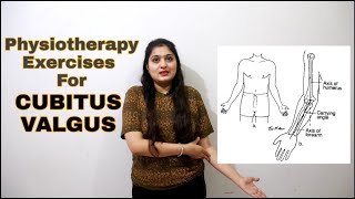 How to cure CUBITUS VALGUS  Carrying Angle Elbow क्या होता है  Cure Carrying Angle Elbow [upl. by Meunier543]