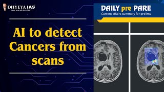 DAILY prePARE AI to detect Cancers from scans  Dhyeya IAS [upl. by Timmons]