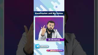 Kwashiorkor Vs Marasmus  Quick Bites [upl. by Koblick]