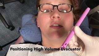 Positioning High Volume Evacuator [upl. by Kristoforo]