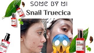 Review SNAIL TRUECICA miracle Repair Serum 🐌 SOMEBY MI [upl. by Emmerich]