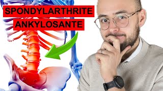 La Spondylarthrite ankylosante  les symptomes dun mal de dos pas comme les autres [upl. by Plante377]