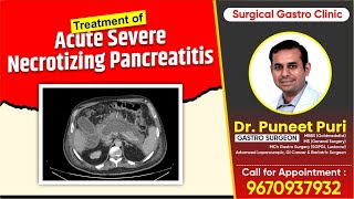 Treatment of Acute Severe Necrotizing Pancreatitis  Dr Puneet Puri  9670937932 acutepancreatitis [upl. by Falo]