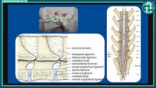 CAM LIVE Lumbosacral disease with Diane Messum [upl. by Vasilek]