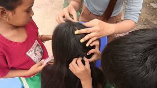 oil hair lice picking in asmr lice hair in dandruff treatment MaChildren [upl. by Rebecca]