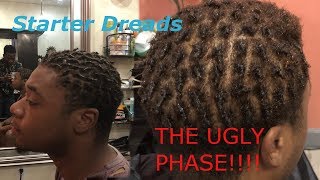 Starter Dreads The Ugly Stage of Dreadlocs [upl. by Ahsitahs107]