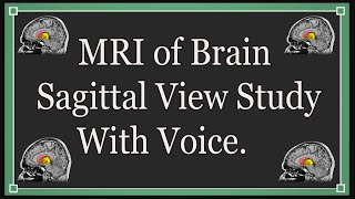 MRI of brain sagittal view study with voice [upl. by Anerys]