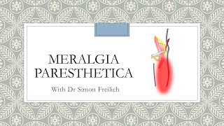 Meralgia Paresthetica [upl. by Fanchet592]