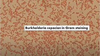 Burkholderia cepacia in Gram Staining of Culture Mag4000X [upl. by Yrrehc544]